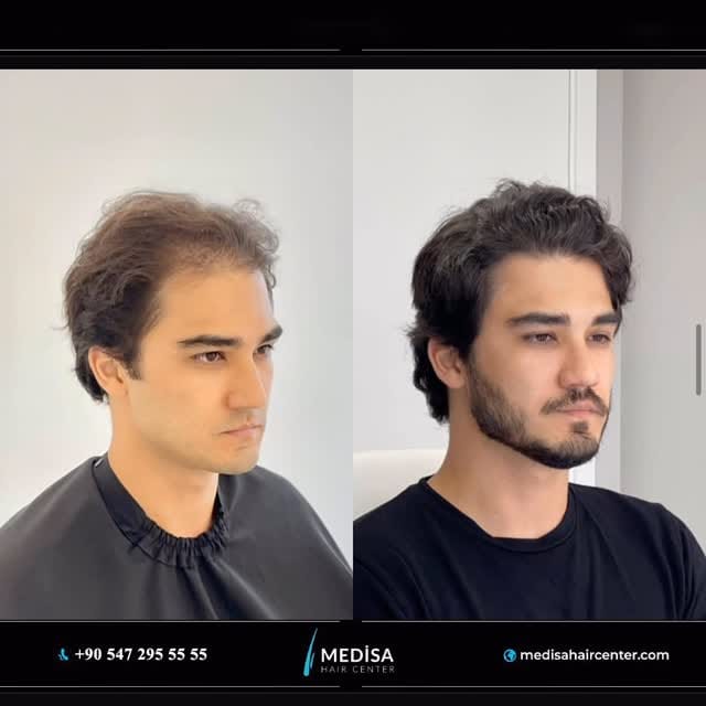 Post 6 by Medisa Hair Center on Instagram (video)