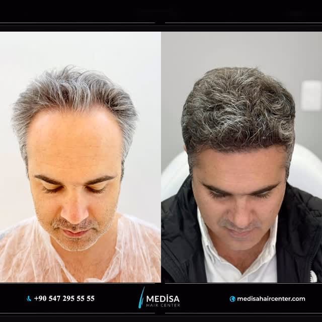 Post 9 by Medisa Hair Center on Instagram (video)