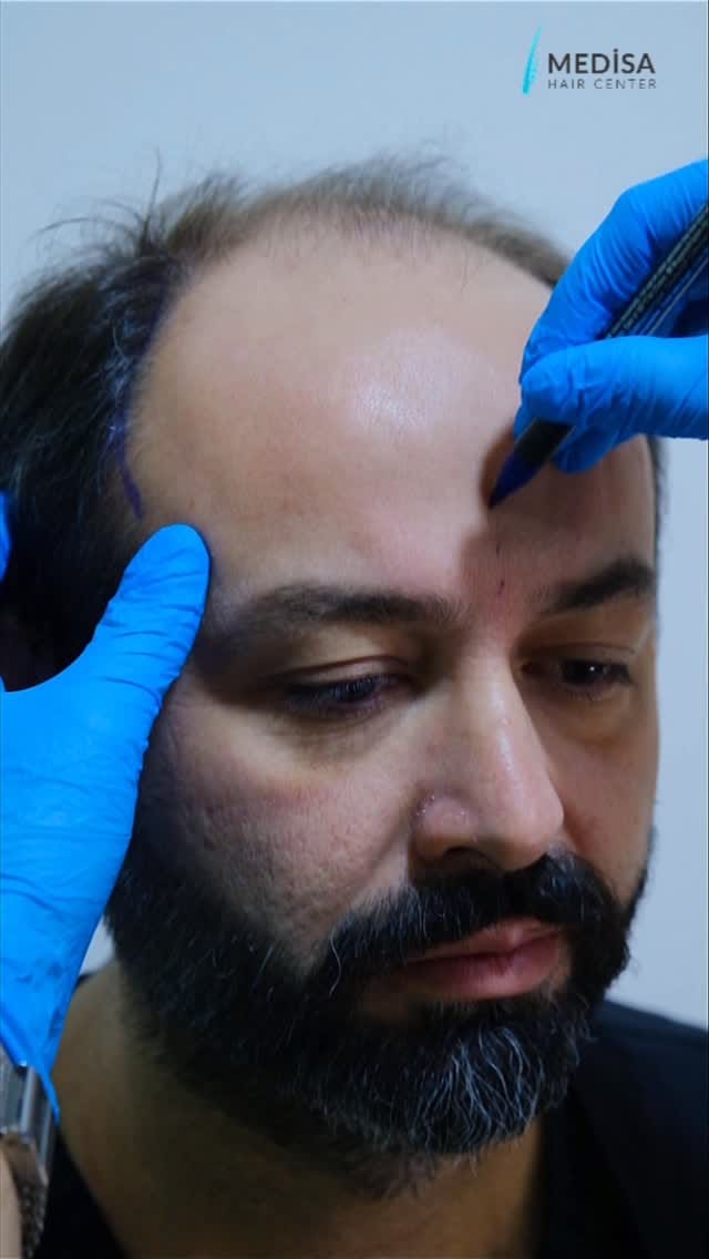 Post 7 by Medisa Hair Center on Instagram (video)