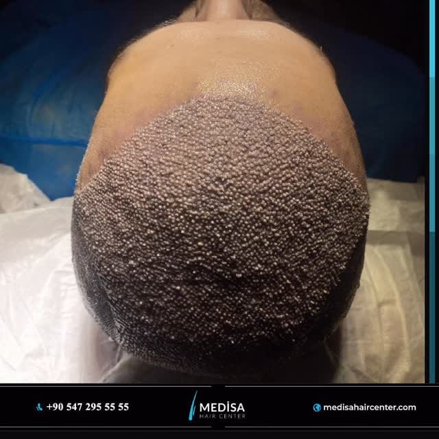 Post 8 by Medisa Hair Center on Instagram (video)