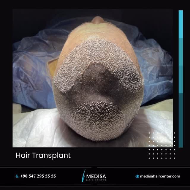Post 5 by Medisa Hair Center on Instagram (video)