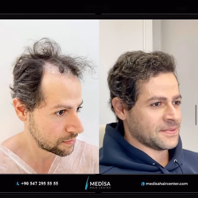 Post 3 by Medisa Hair Center on Instagram (video)