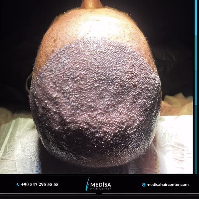Post 2 by Medisa Hair Center on Instagram (video)
