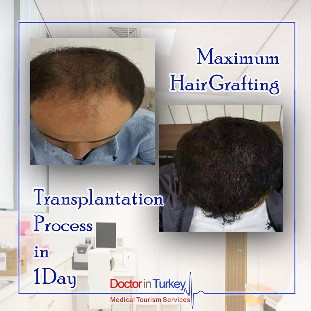 Post 1 by Doctor in Turkey on Instagram (image)