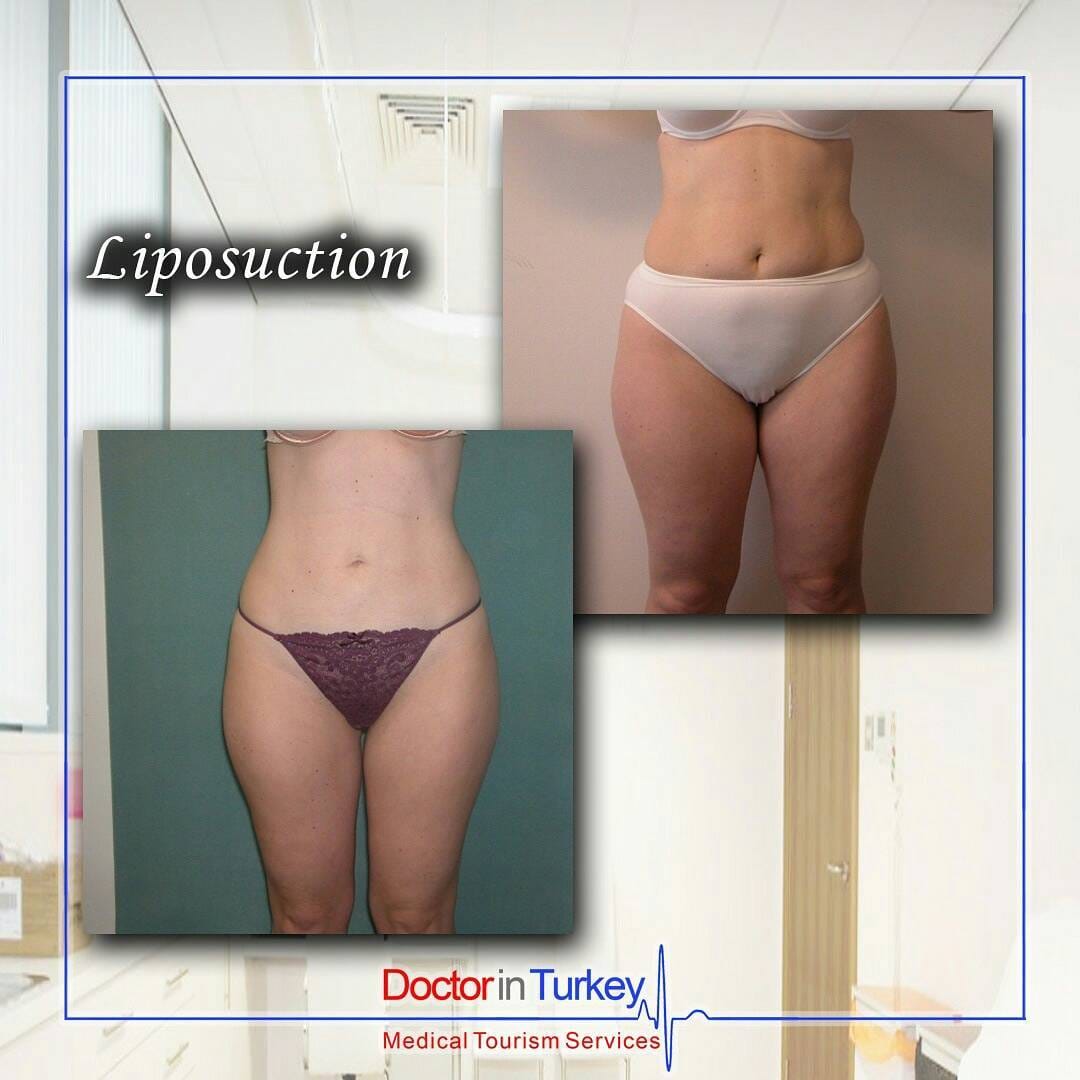 Post 6 by Doctor in Turkey on Instagram (carousel)