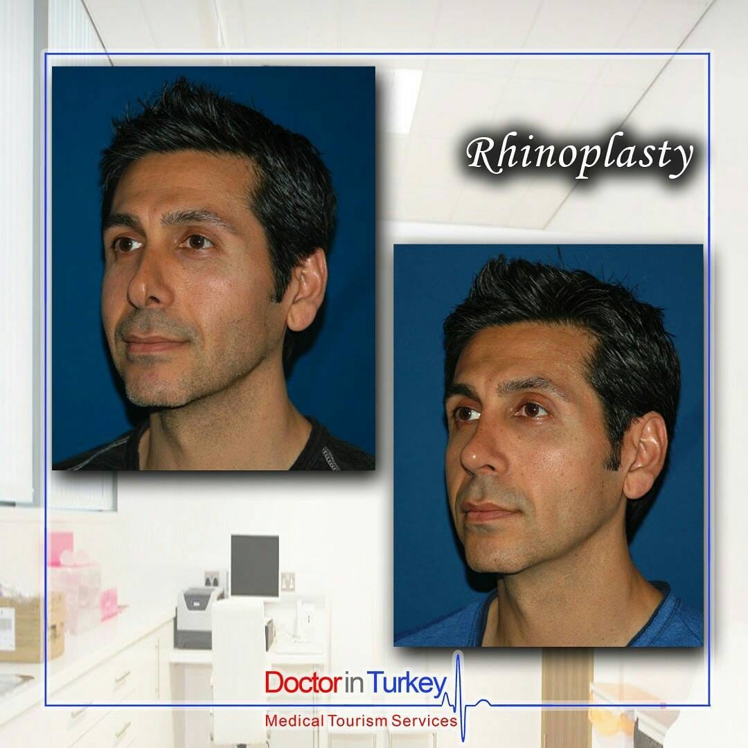 Post 8 by Doctor in Turkey on Instagram (carousel)