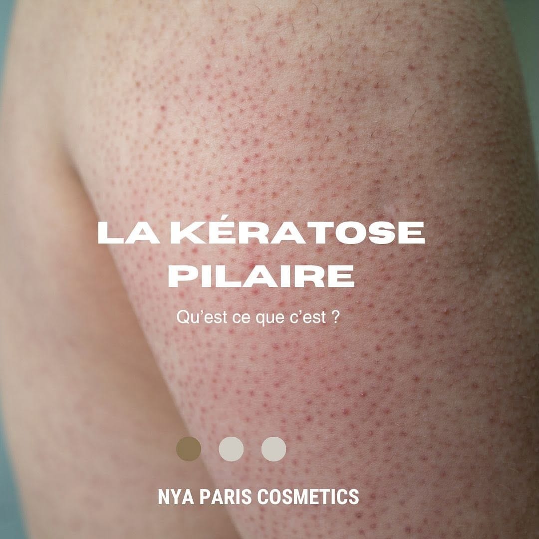 Post 5 by NYA PARIS COSMETICS on Instagram (carousel)