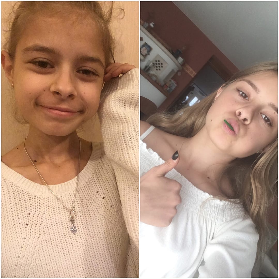 Post 9 by Anorexia Survivor 🐙 on Instagram (carousel)
