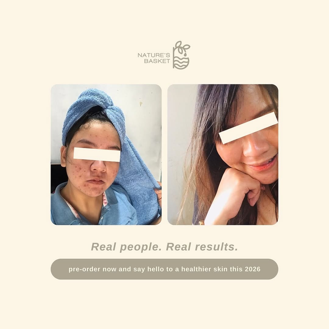 Post 3 by ALL NATURAL SKINCARE on Instagram (carousel)