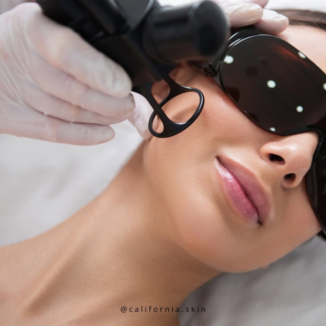 Post 2 by California Skin on Instagram (image)
