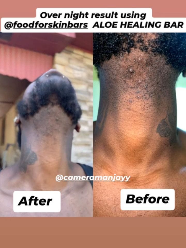 Post 8 by Food For Skin Bars on Instagram (carousel)