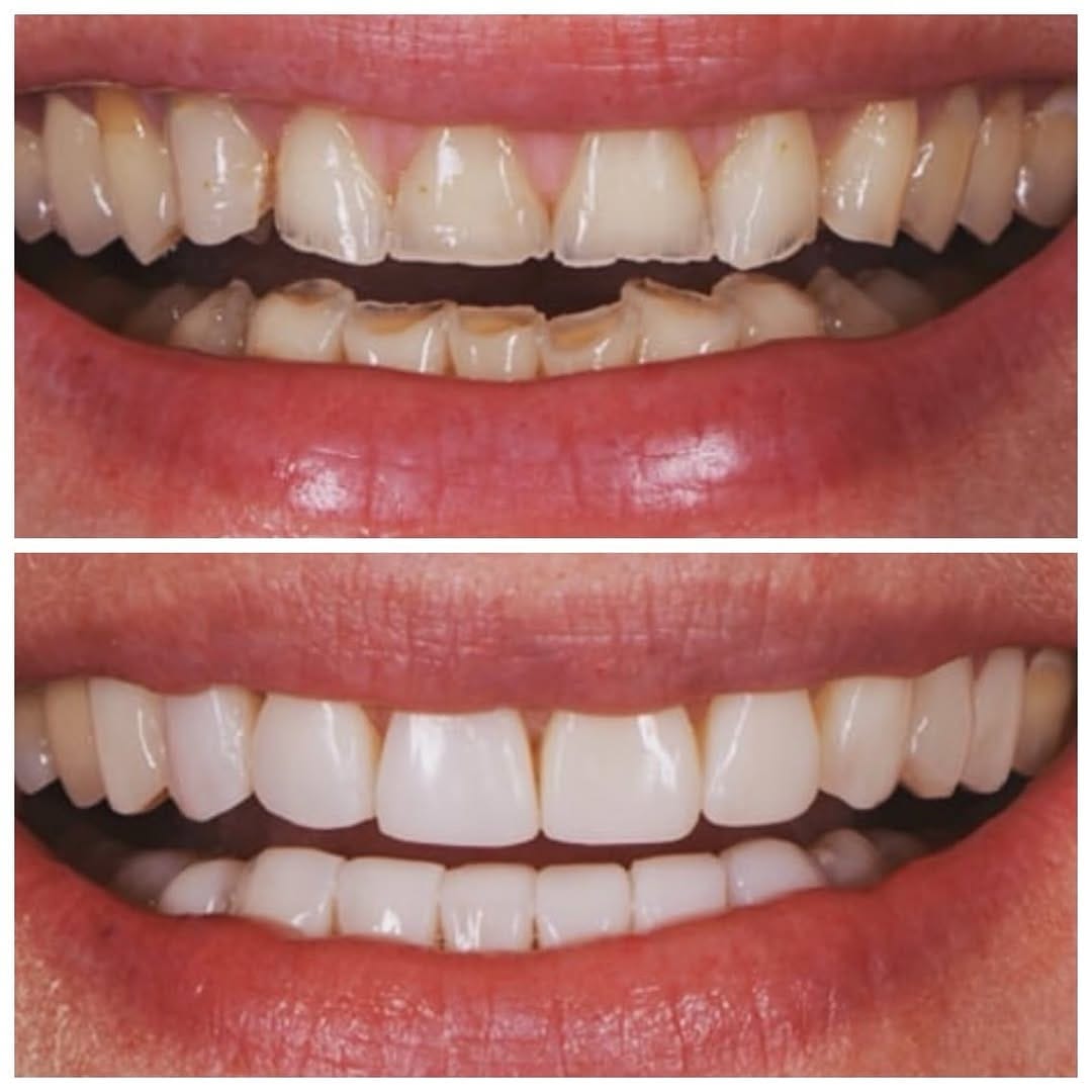 Post 4 by Olga Papasotiriou Dr.med.dent., MSD, FICD on Instagram (image)
