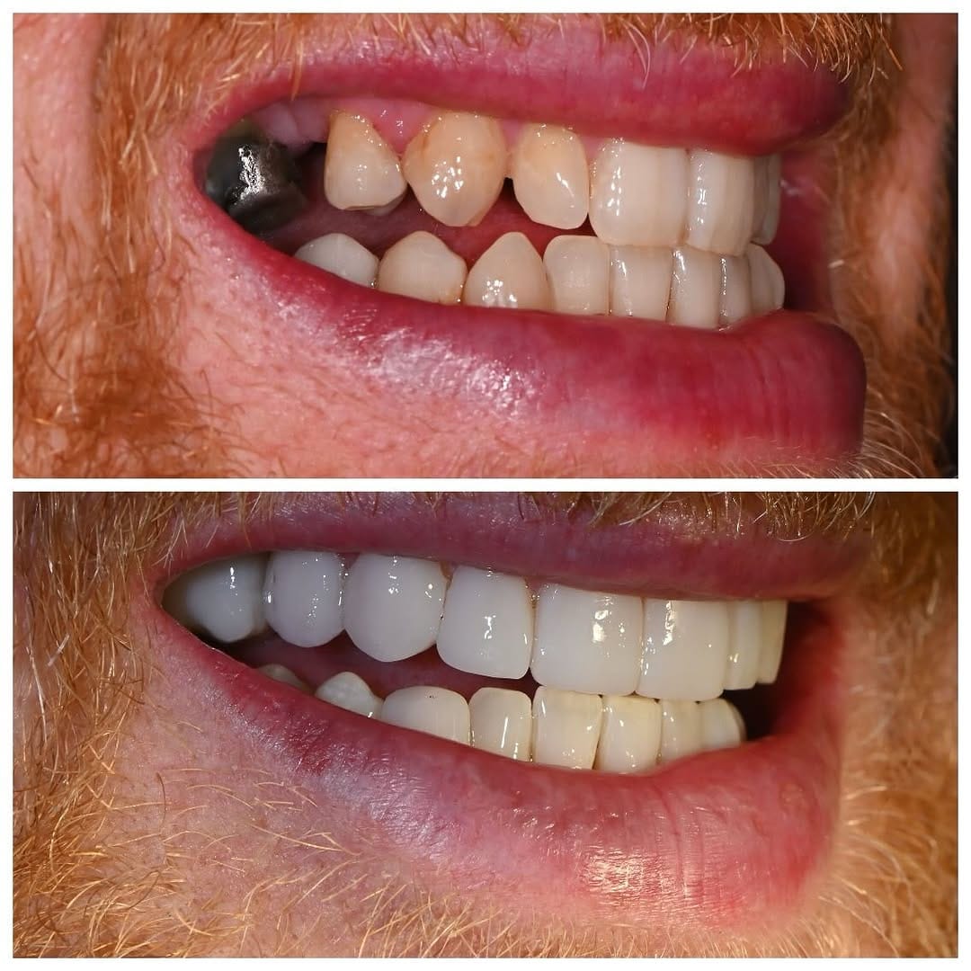 Post 6 by Olga Papasotiriou Dr.med.dent., MSD, FICD on Instagram (carousel)