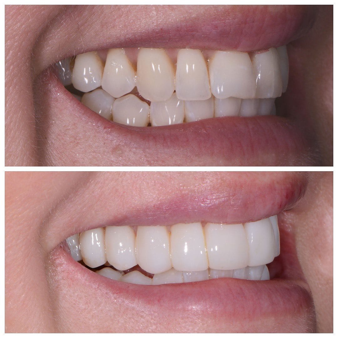 Post 10 by Olga Papasotiriou Dr.med.dent., MSD, FICD on Instagram (carousel)