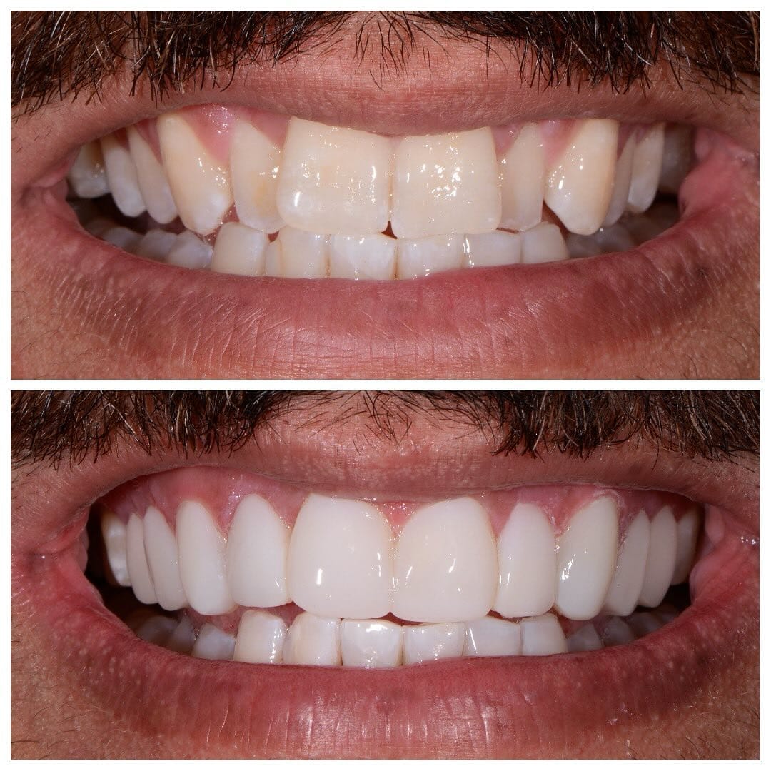 Post 9 by Olga Papasotiriou Dr.med.dent., MSD, FICD on Instagram (image)