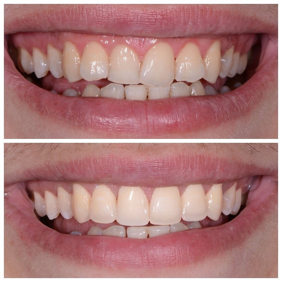 Post 7 by Olga Papasotiriou Dr.med.dent., MSD, FICD on Instagram (carousel)