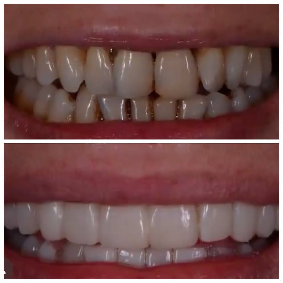 Post 3 by Olga Papasotiriou Dr.med.dent., MSD, FICD on Instagram (carousel)