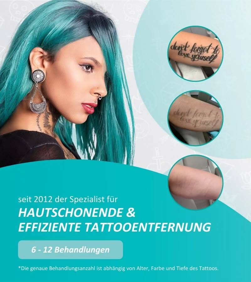 Post 10 by ENDLICH OHNE TATTOOENTFERNUNG on Instagram (image)