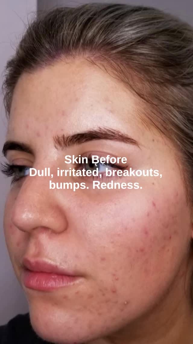 Post 1 by 🐝🐝🐝 on Instagram (video)