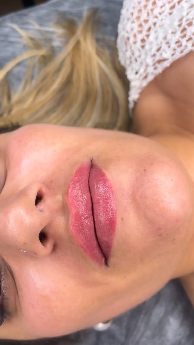 Post 6 by Uzm. Est. MERVE DENİZ on Instagram (video)