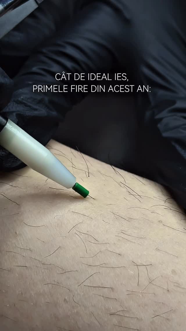 Post 7 by Ina | 𝗘𝗟𝗘𝗖𝗧𝗥𝗢𝗘𝗣𝗜𝗟𝗔𝗥𝗘 on Instagram (video)