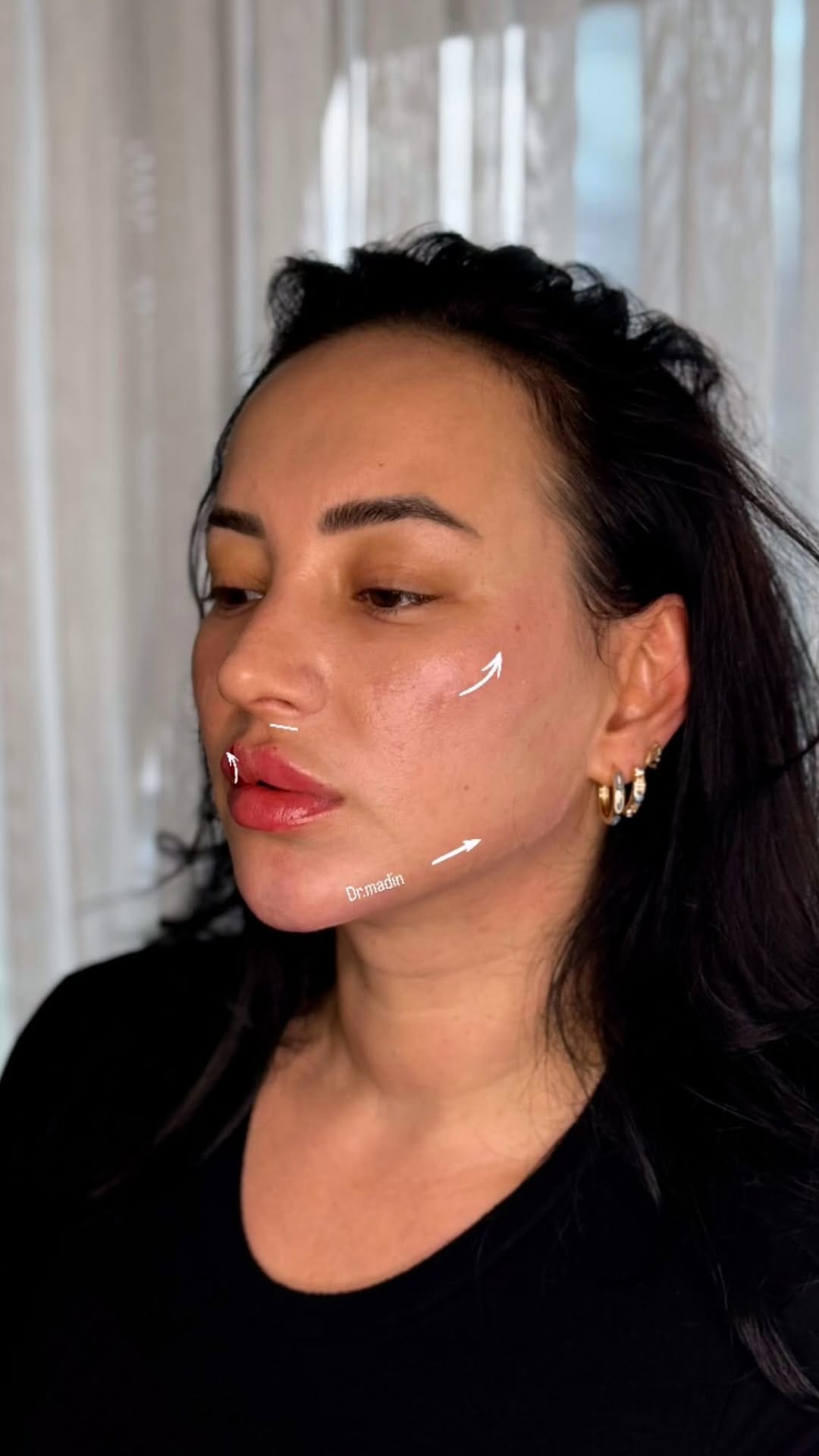 Post 1 by COSMETOLOGY VlENNA on Instagram (video)