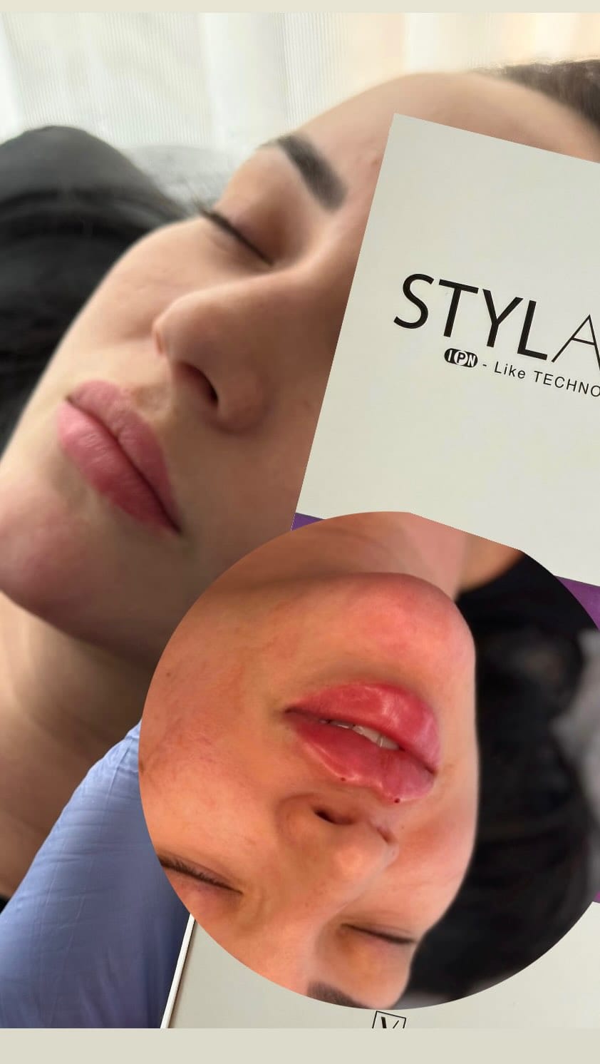 Post 7 by COSMETOLOGY VlENNA on Instagram (video)
