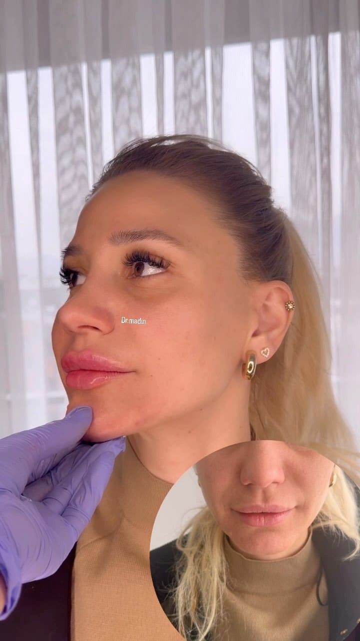 Post 8 by COSMETOLOGY VlENNA on Instagram (video)