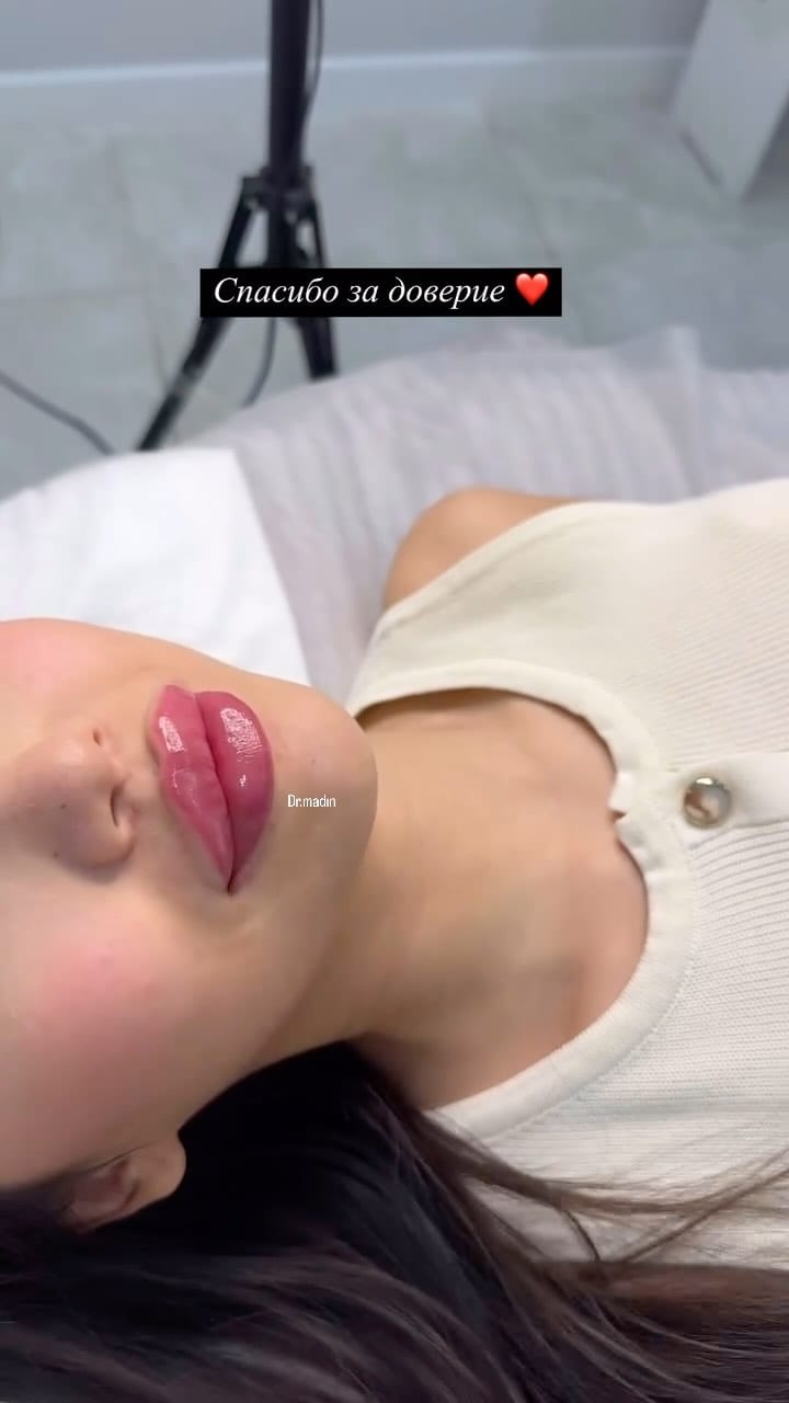Post 10 by COSMETOLOGY VlENNA on Instagram (video)