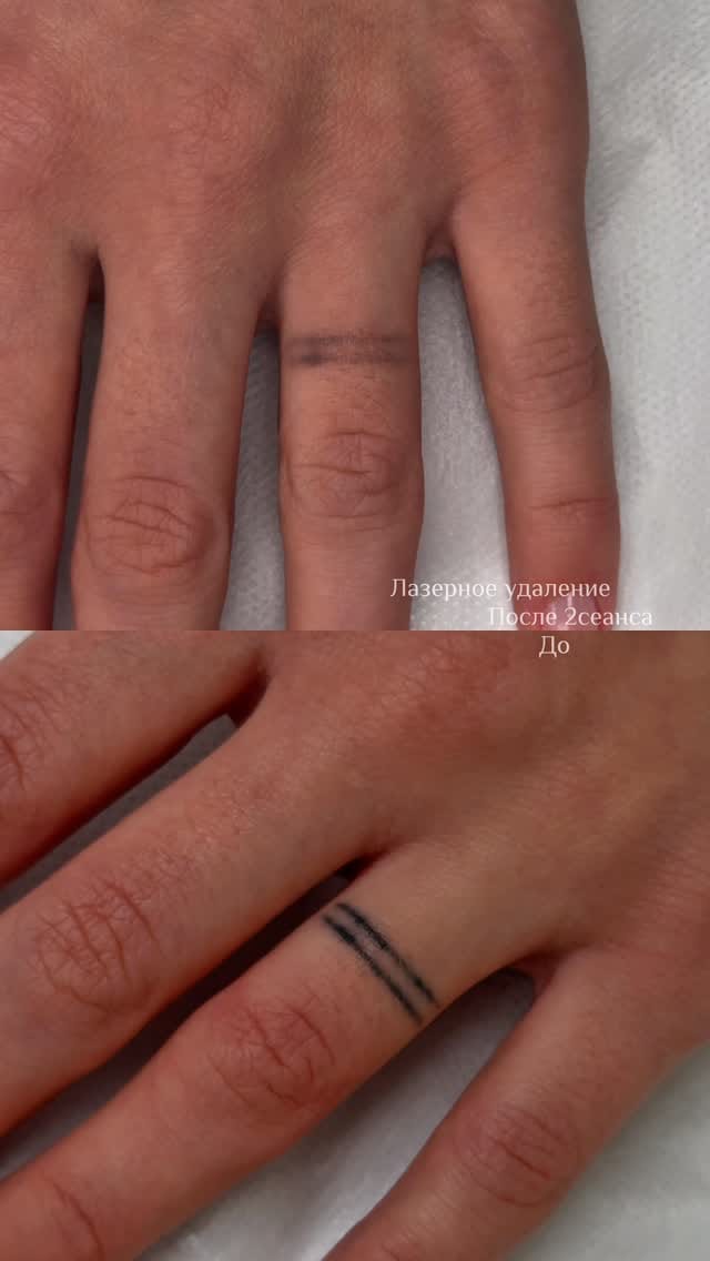 Post 1 by ⁣ ПЕРМАНЕНТ|ЭПИЛЯЦИЯ|ФОТООМОЛОЖЕНИЕ|ДОМОДЕДОВО on Instagram (video)