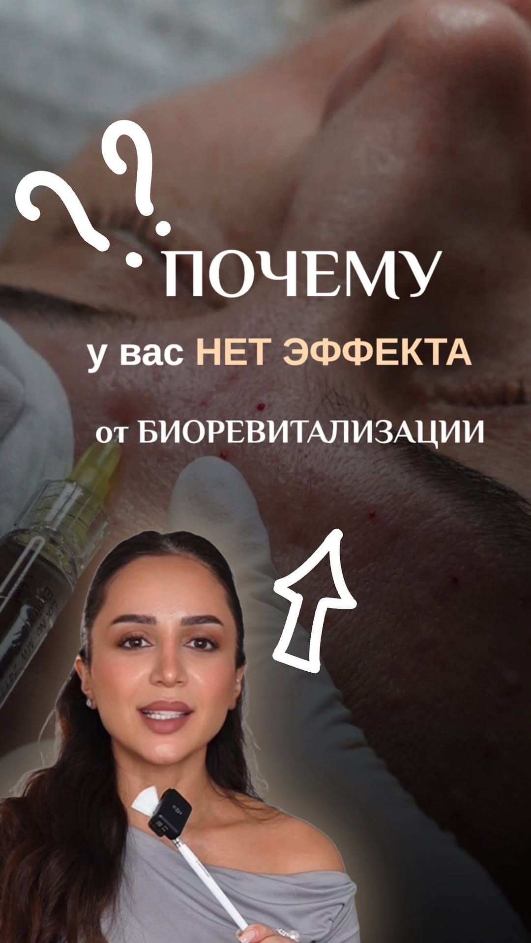 Post 7 by ⁣ ПЕРМАНЕНТ|ЭПИЛЯЦИЯ|ФОТООМОЛОЖЕНИЕ|ДОМОДЕДОВО on Instagram (video)
