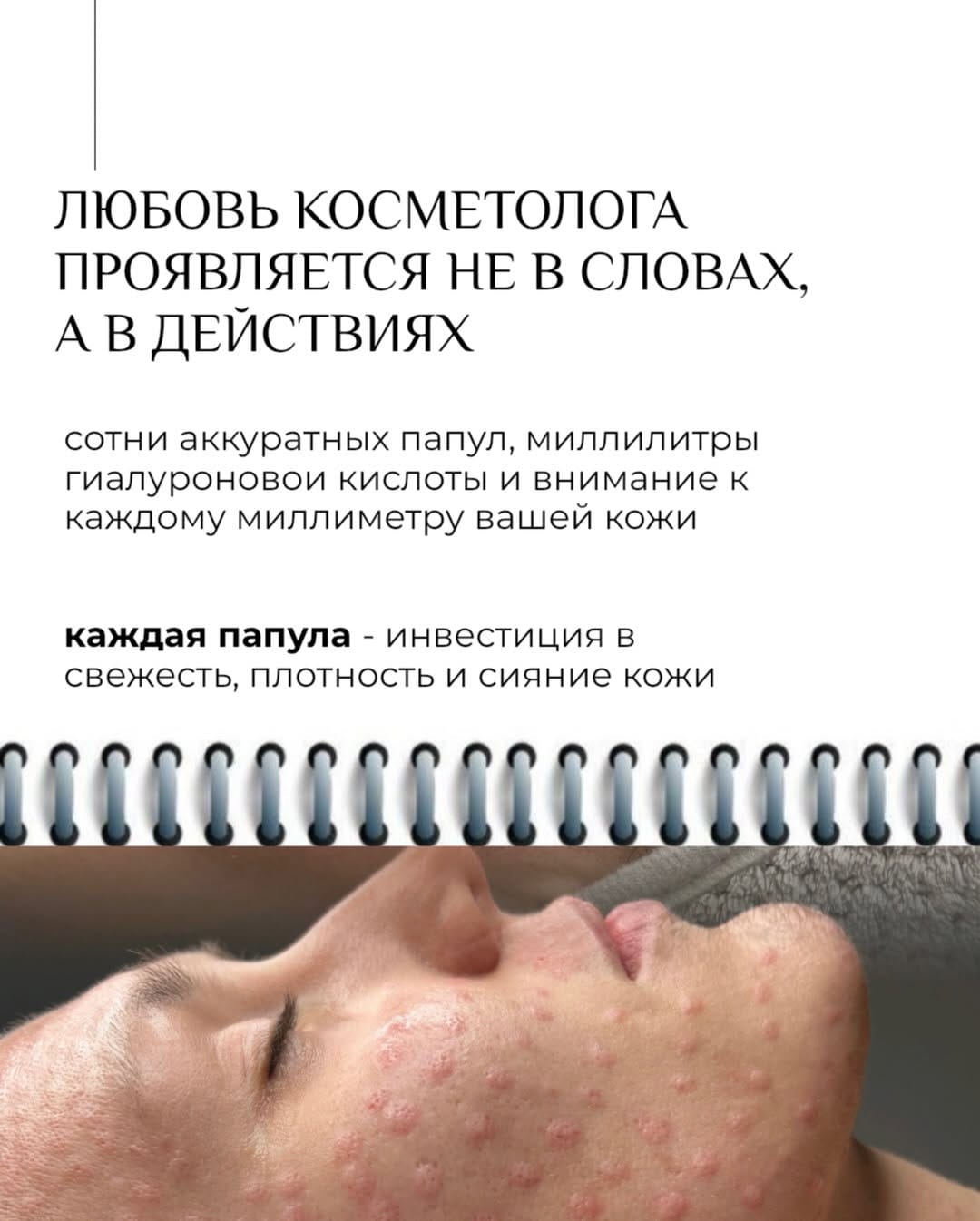 Post 10 by ⁣ ПЕРМАНЕНТ|ЭПИЛЯЦИЯ|ФОТООМОЛОЖЕНИЕ|ДОМОДЕДОВО on Instagram (carousel)