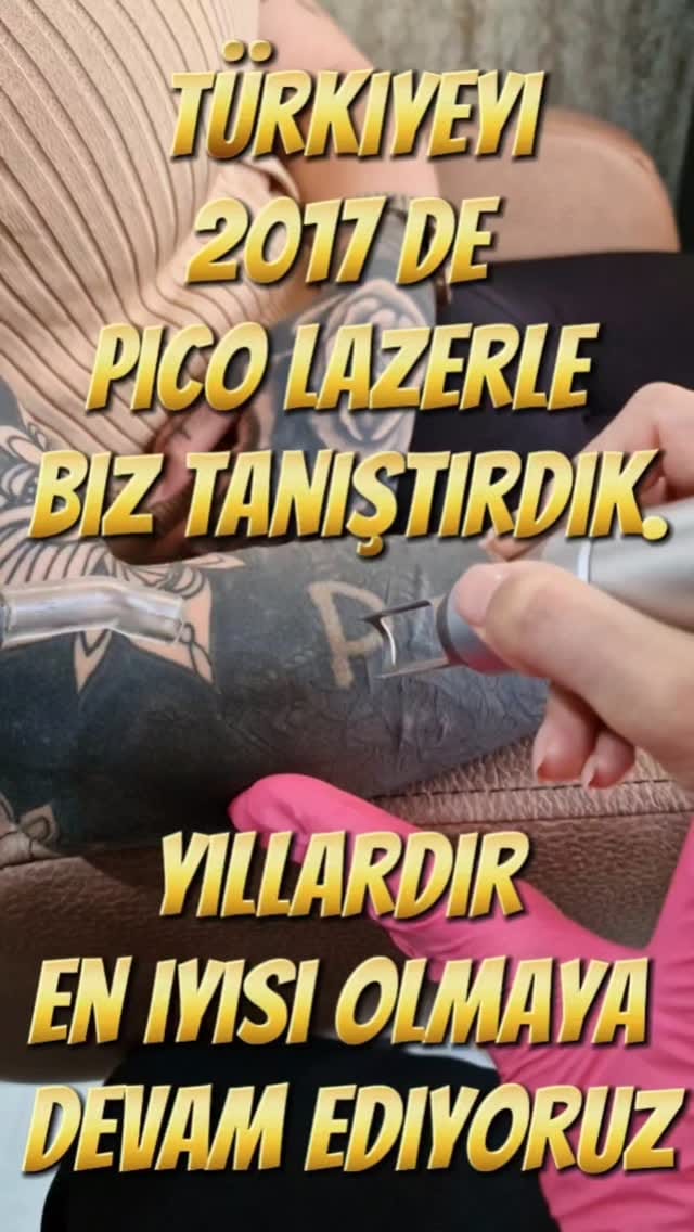 Post 5 by izmir dövme silme merkezi on Instagram (video)
