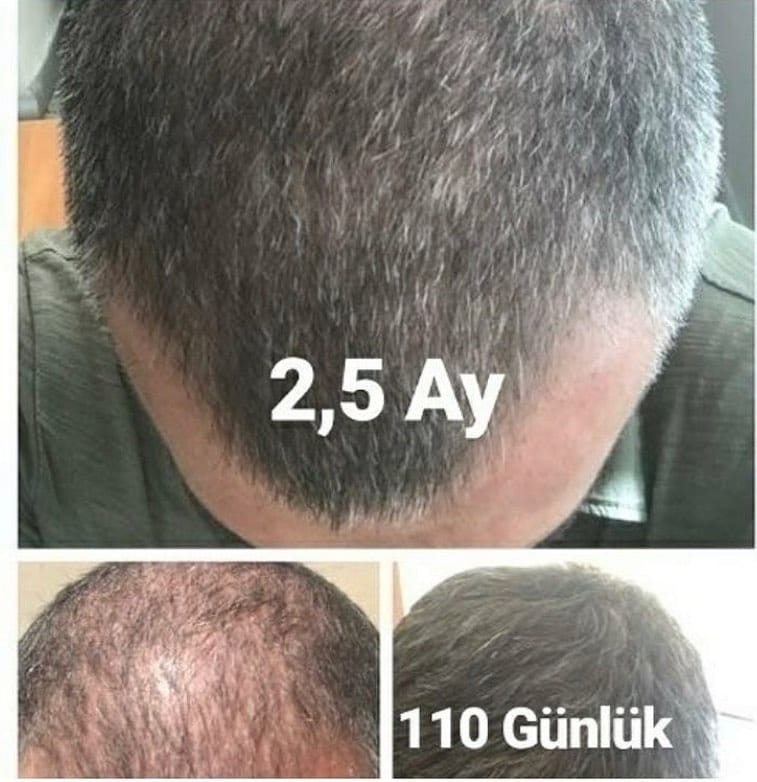 Post 4 by Mavi Serum Satış Sayfası on Instagram (image)
