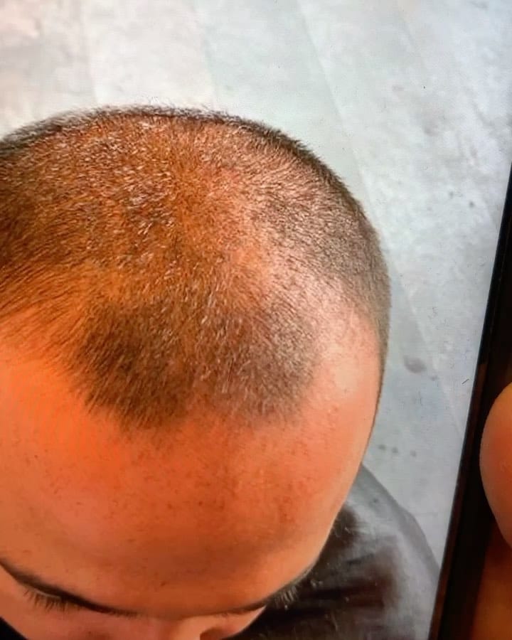 Post 2 by Mavi Serum Satış Sayfası on Instagram (video)