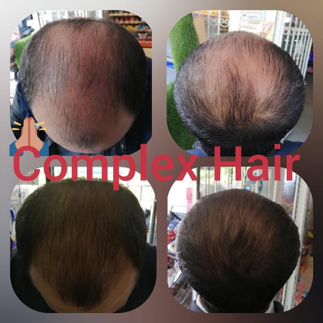 Post 5 by Mavi Serum Satış Sayfası on Instagram (image)