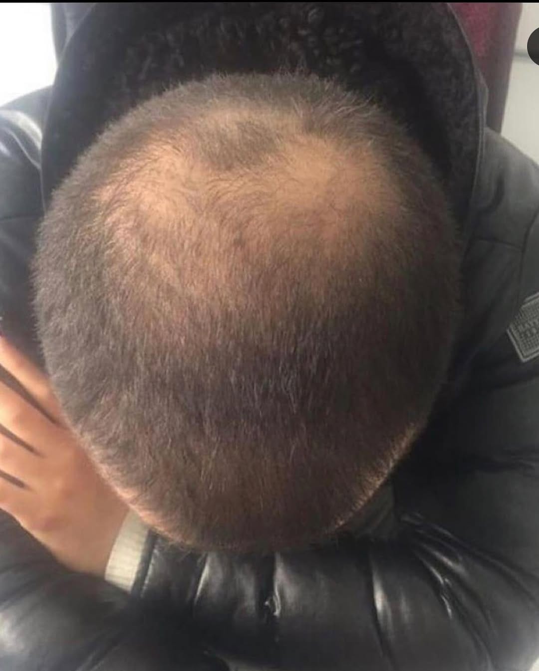 Post 3 by Mavi Serum Satış Sayfası on Instagram (carousel)