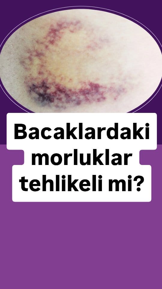 Post 7 by Uz.Dr.Volkan Subaşı on Instagram (video)