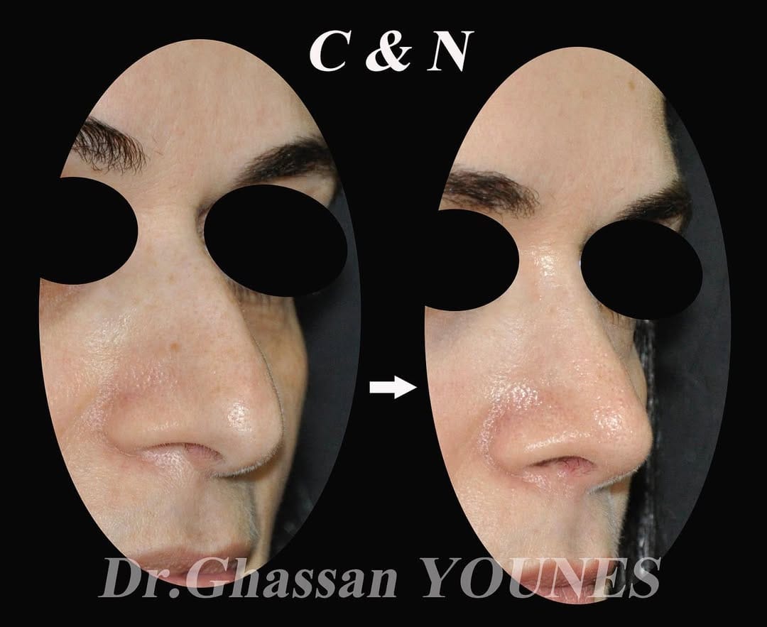 Post 3 by Drghassanyounes on Instagram (image)