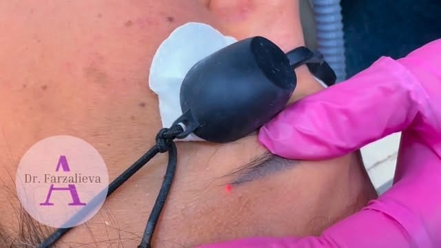 Post 7 by Dr.Farzalieva on Instagram (video)