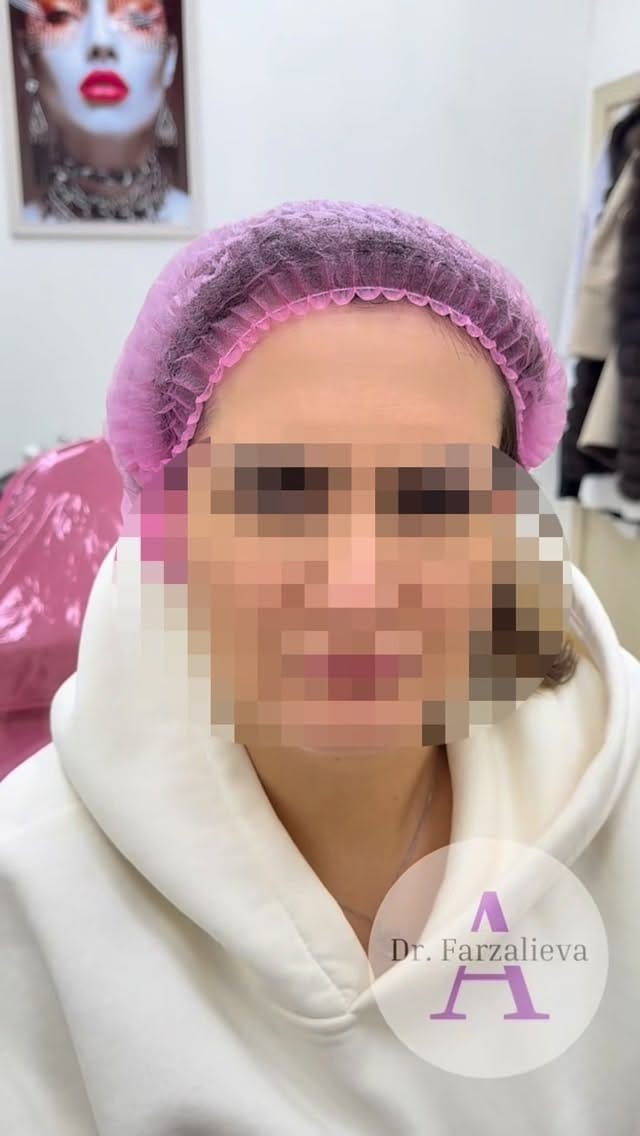 Post 6 by Dr.Farzalieva on Instagram (video)