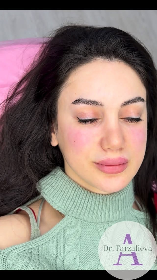 Post 8 by Dr.Farzalieva on Instagram (video)