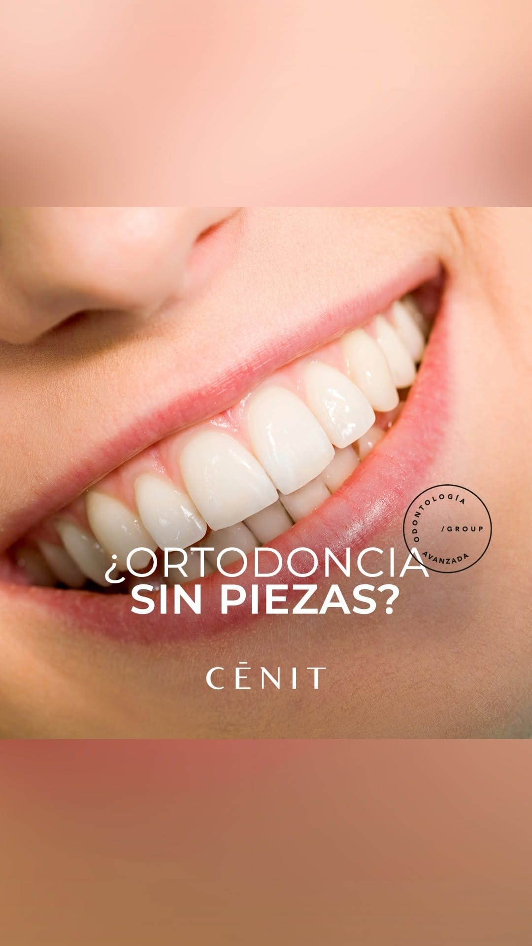Post 2 by CÉNIT Odontología Avanzada on Instagram (video)