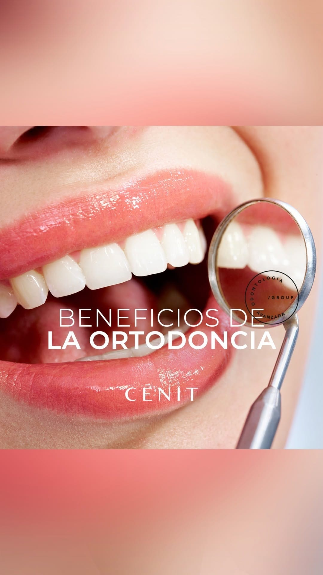 Post 6 by CÉNIT Odontología Avanzada on Instagram (video)