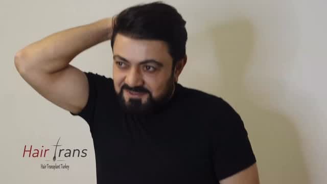Post 4 by Samsun Saç Ekimi Hair Trans on Instagram (video)