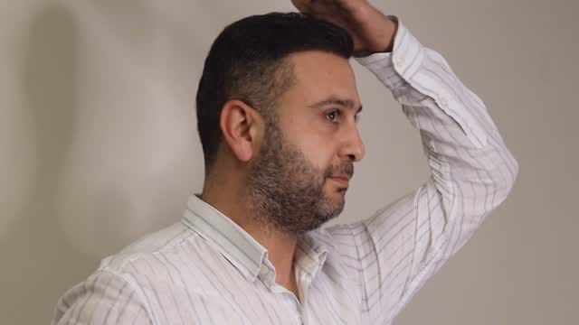Post 5 by Samsun Saç Ekimi Hair Trans on Instagram (video)