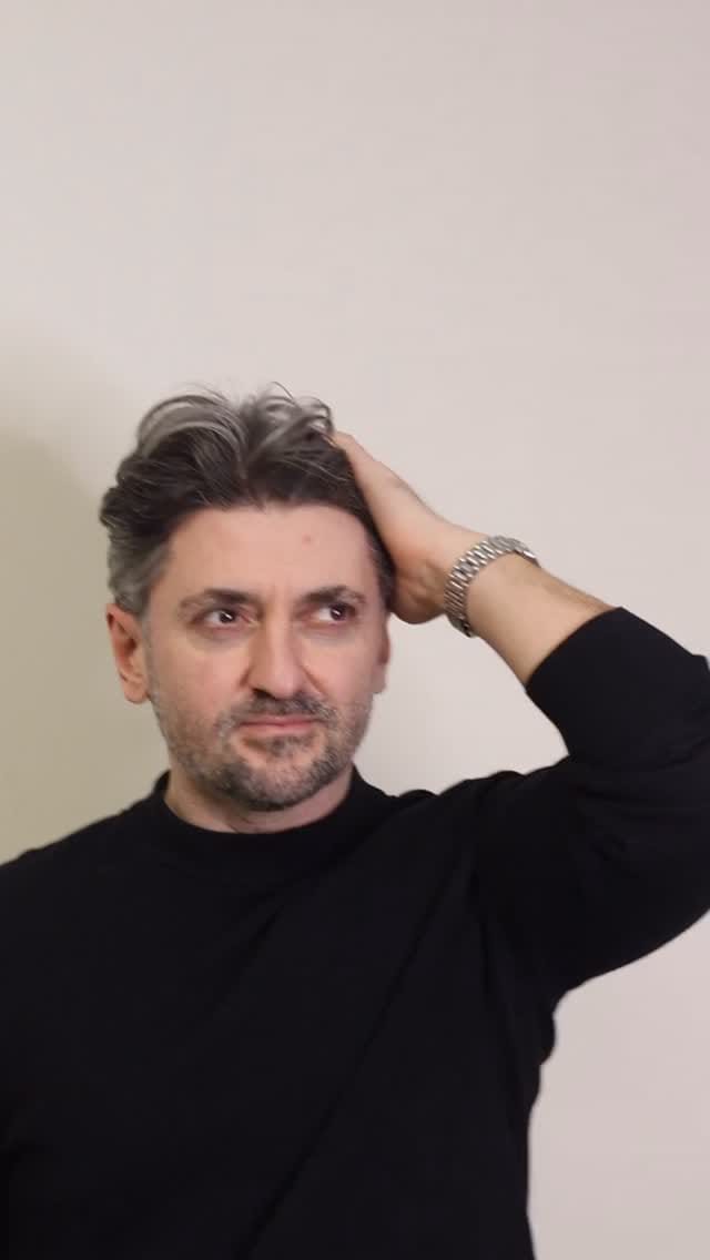 Post 3 by Samsun Saç Ekimi Hair Trans on Instagram (video)
