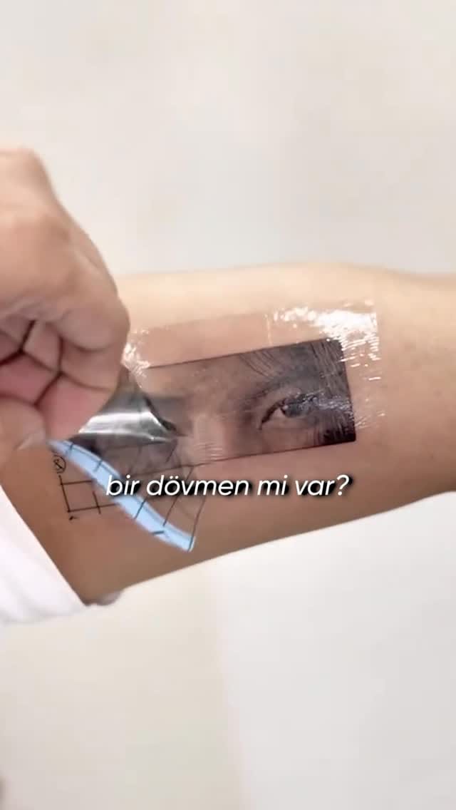 Post 4 by By Emre Tattoo | Sultanbeyli Dövme Silme on Instagram (video)