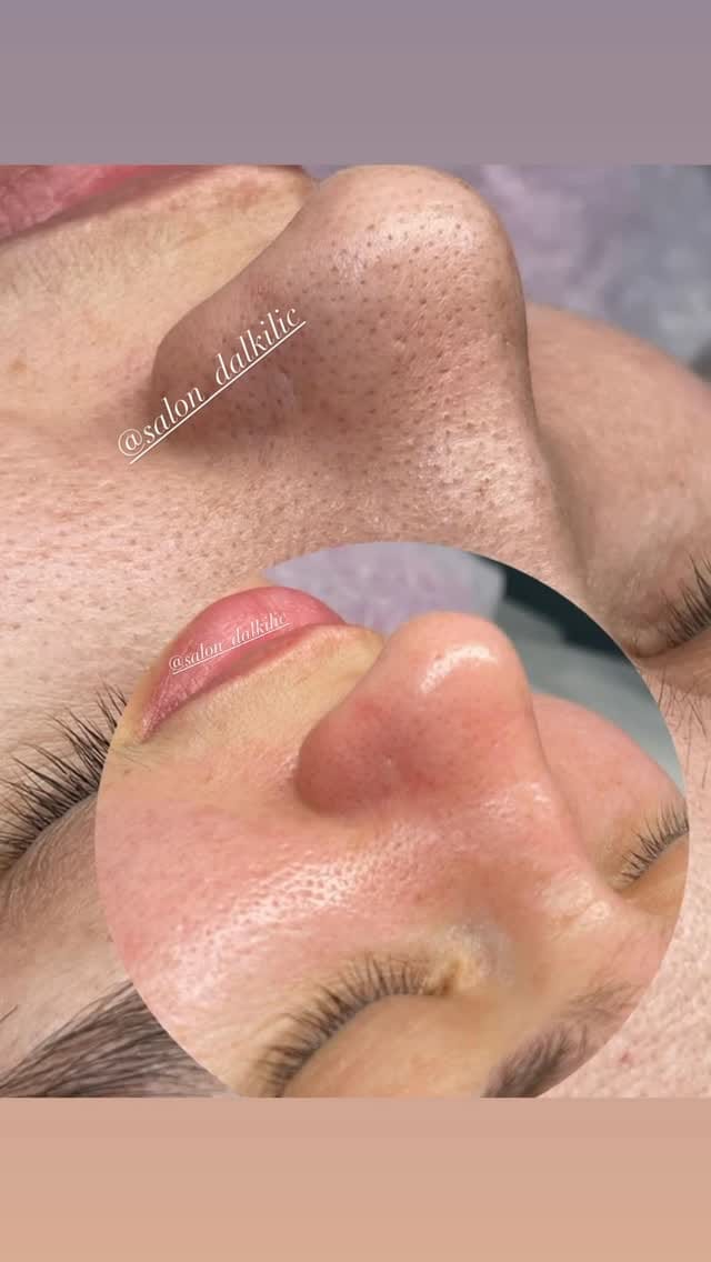 Post 10 by Салон красоты DALKİLİÇ on Instagram (video)
