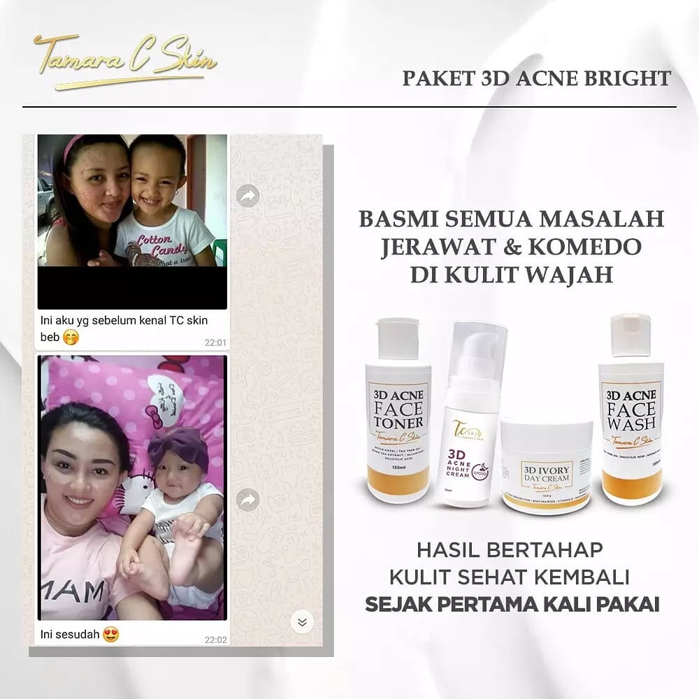 Post 7 by TCSKIN TAMARA C SKINCARE ARTIS on Instagram (image)